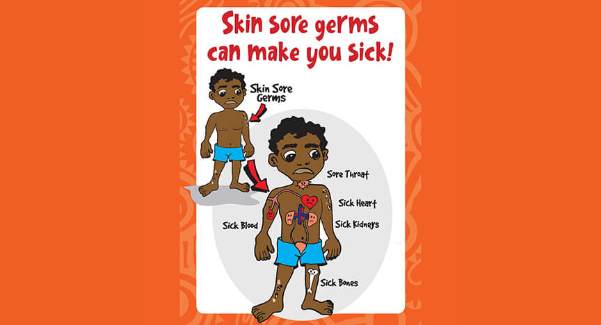 Image for Keep skin clean and healthy and avoid more serious conditions